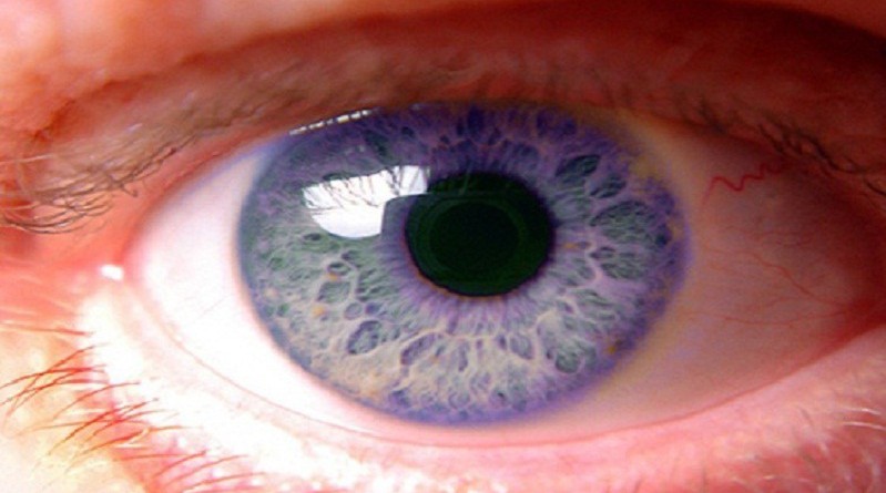 العلماء يتوصلون إلى دواء لسرطان العين