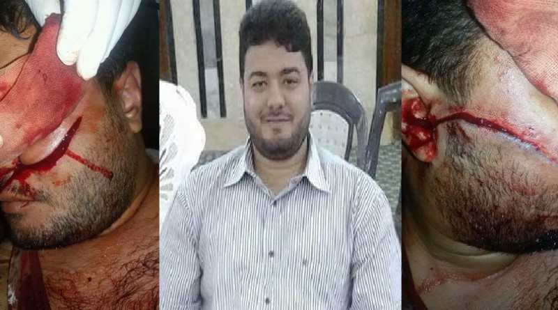 الوفد : ضبط الجناة في حادث تشويه أحد شباب حزب الوفد