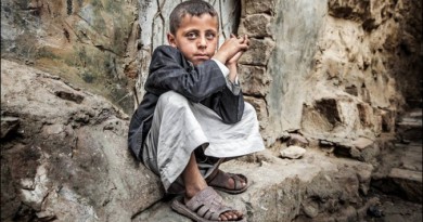 "يونيسيف": مليونا طفل في اليمن يعانون من نقص حاد في التغذية