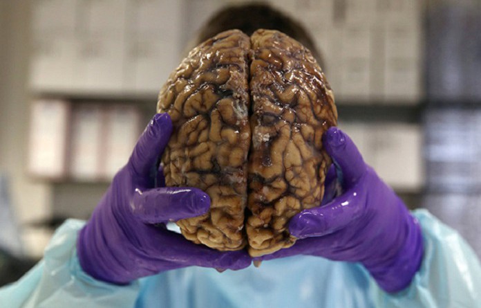 علماء الآثار يعثرون على أقدم دماغ بشري في العالم