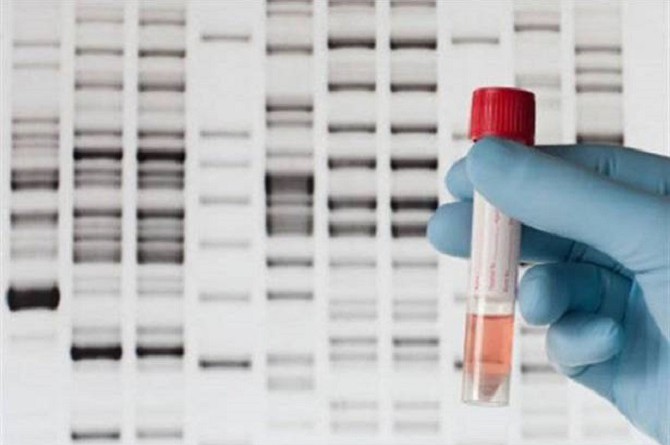 لا تحاول معرفة من أين جاء أجدادك.. مرض خطير قد يواجهك إذا أجريت اختبار الحمض النووي DNA