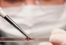 تحليل جديد للدم يعزز آمال اكتشاف السرطان مبكراً