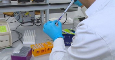 علماء يكتشفون بروتينا "يمكنه وقف نمو الفيروسات"
