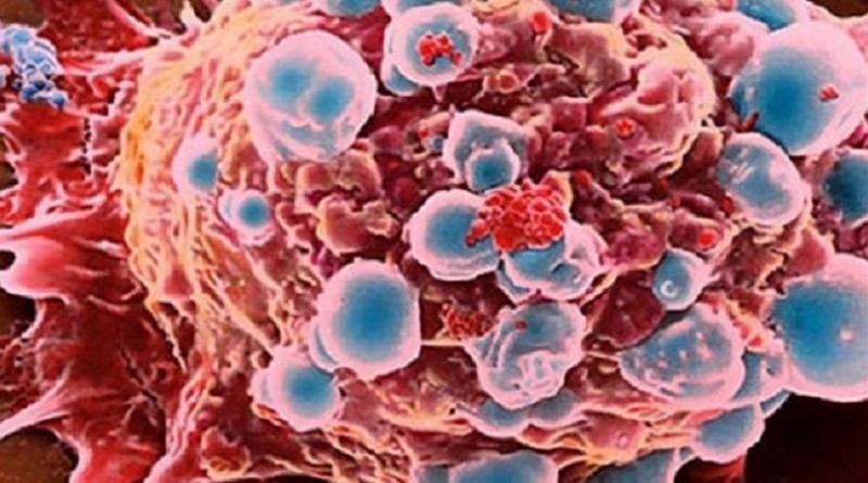 بحث أمريكي: مكملات الزنك يمكن أن توقف نمو الخلايا السرطانية