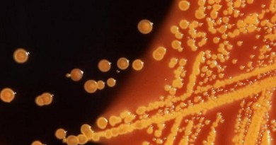 المنتجات المعتمدة على اللحم النيئ ربما تضر الحيوانات الأليفة وأصحابها