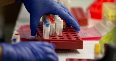 بشري لمرضى الإيدز