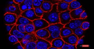 اكتشاف جزيئات خاصة بالخلايا تودى لنمو السرطان