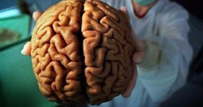 دراسة جديدة تغيرات المخ قد تؤدي إلى الخرف