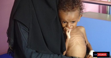 50 مليون شخص في المنطقة يعانون من "نقص التغذية"