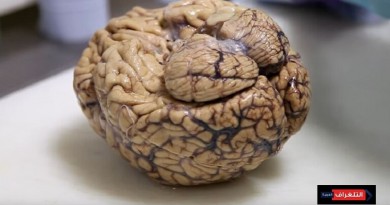 دماغ غامض في جمجمة مقتول