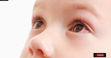احمرار العيون عند الأطفال..اسبابه وعلاجه وطرق الوقاية منه